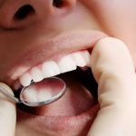 آینه دندانپزشکی و کاربرد آن
