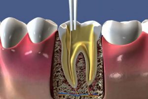 جراحی و ترمیمی