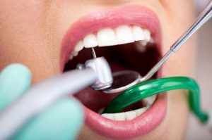 مواد کف بندی در دندان پزشکی